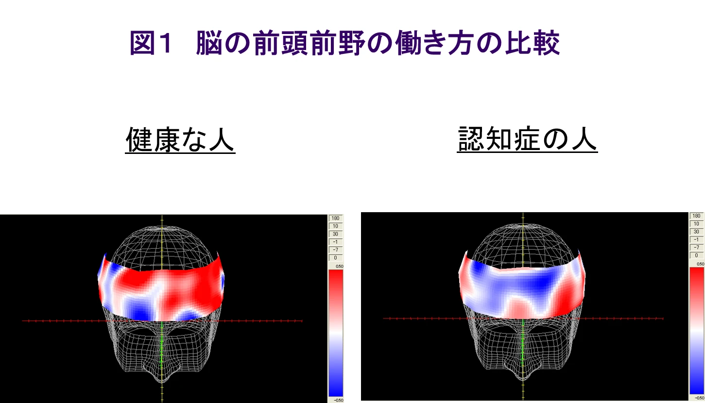 脳の前頭前野の働き方の比較